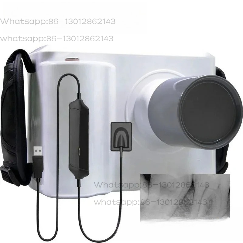 Full Set Portable Dental X ray - Veterinary X-Ray recension och pris