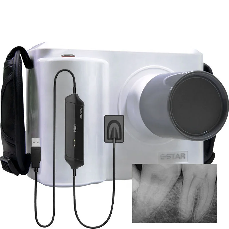 Full Set Portable Dental X ray - Veterinary X-Ray recension och pris