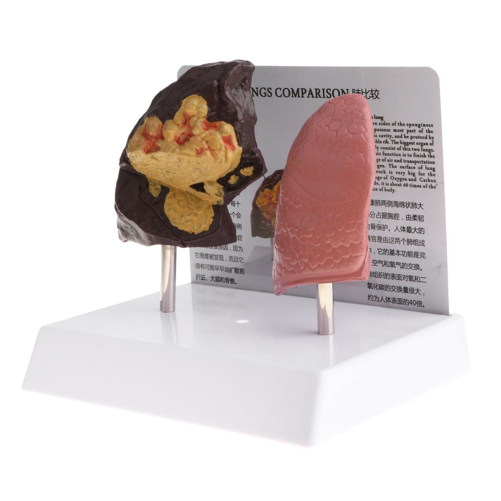 Human Lung Normal Comparison M - Medical Lab Supplies recension och pris