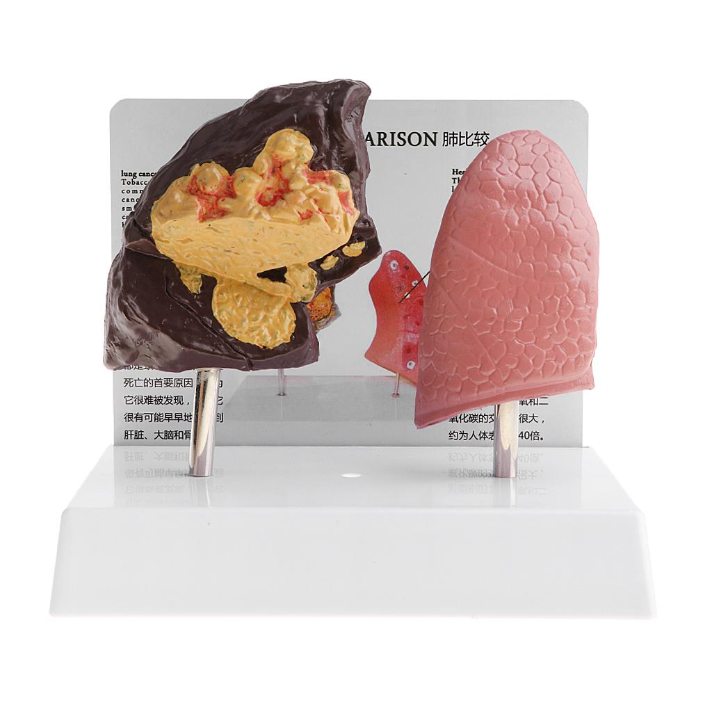 Human Lung Normal Comparison M - Medical Lab Supplies recension och pris