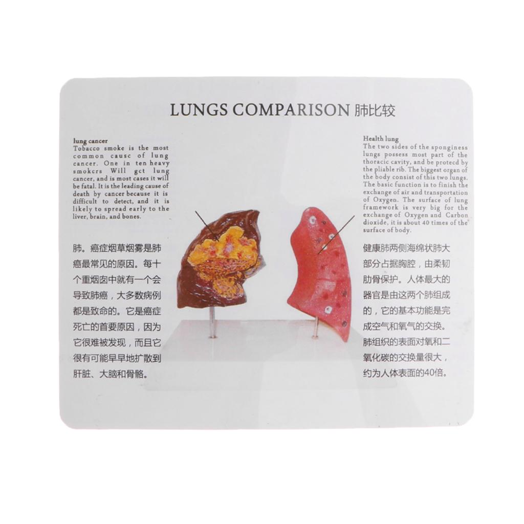 Human Lung Normal Comparison M - Medical Lab Supplies recension och pris