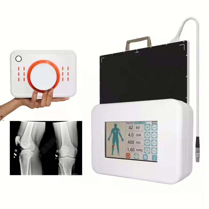 Portable Small Size Hand-Held  - Veterinary X-Ray recension och pris