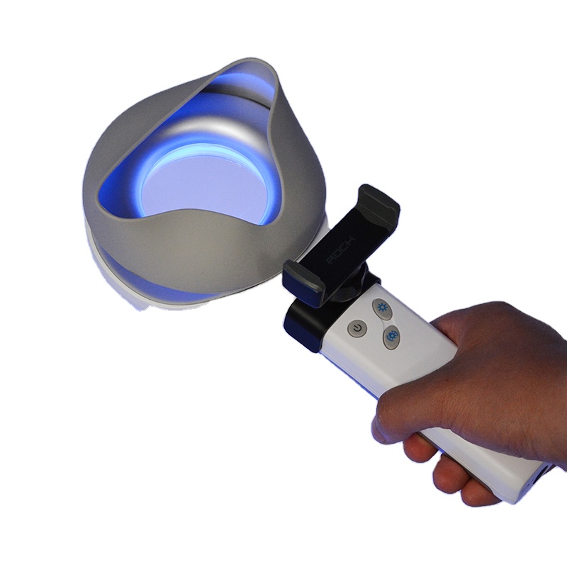Skin Disorder  Depigmentation  - Led Medical Headlight recension och pris