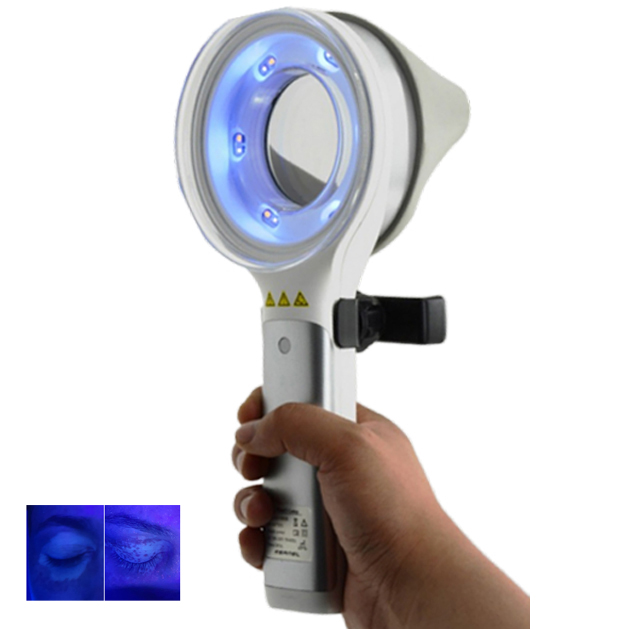 Skin Disorder  Depigmentation  - Led Medical Headlight recension och pris