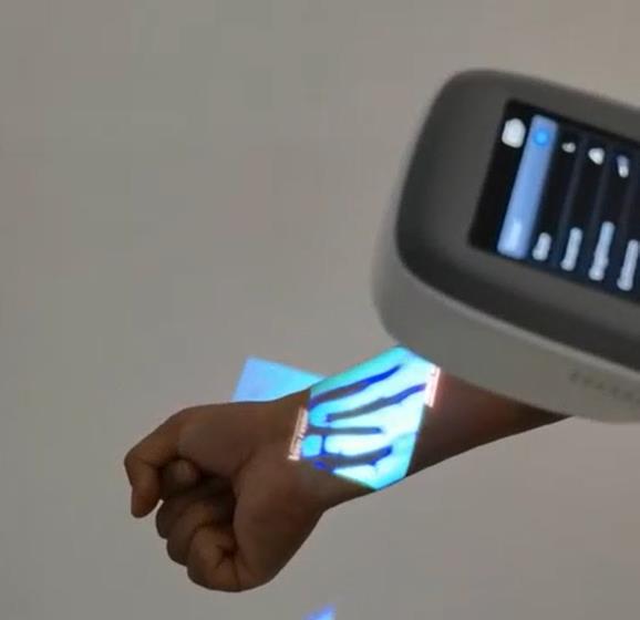 QV-600 Medical Vein Finder Vie - Medical Lab Images recension och pris