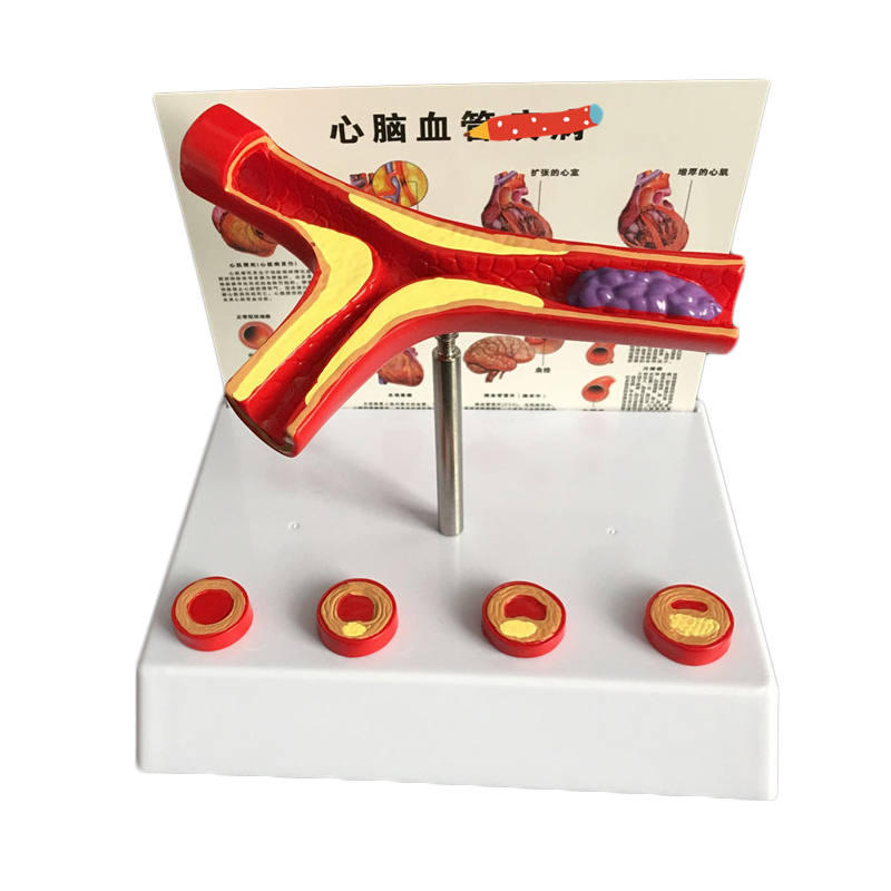 50 Times Enlarged Human Vessel - Medical Lab Supplies recension och pris